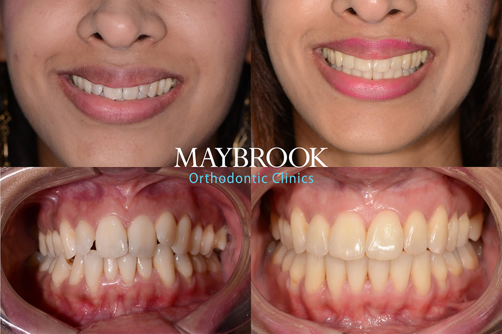 G testimonial for Maybrook Clinic
