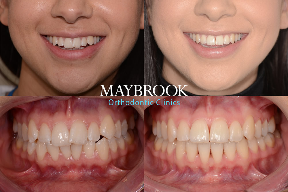 HD testimonial for Maybrook Clinic