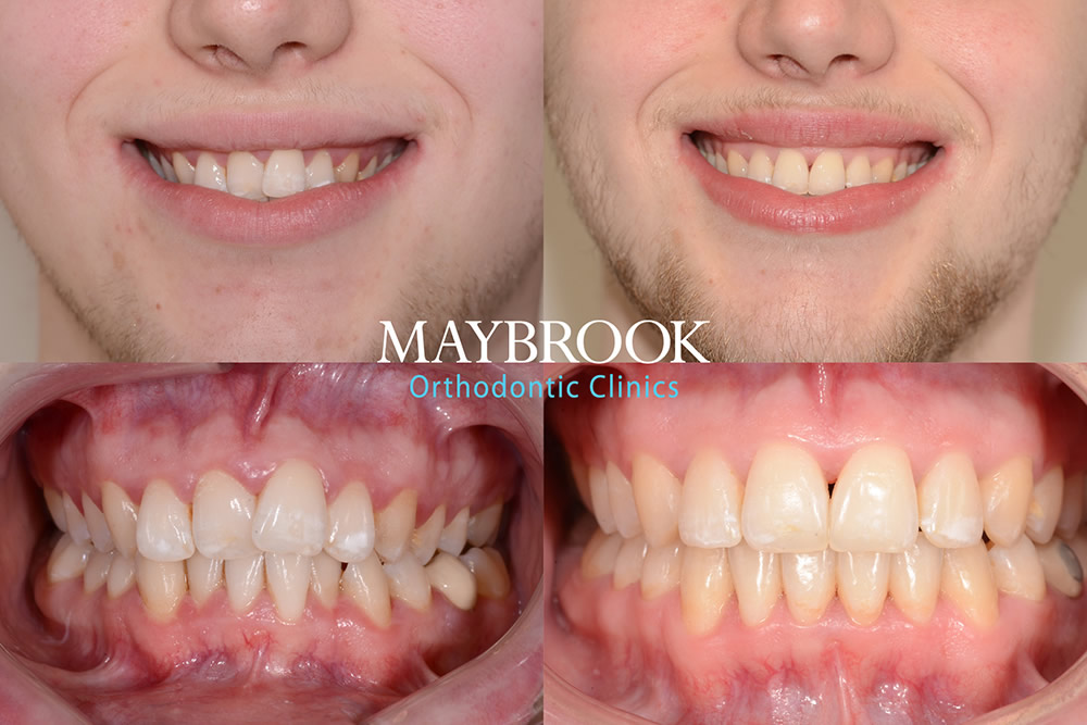 Luke testimonial for Maybrook Clinic