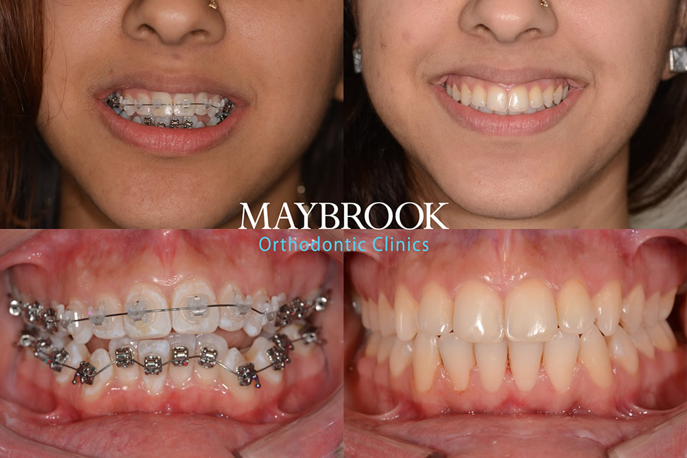 R testimonial for Maybrook Clinic